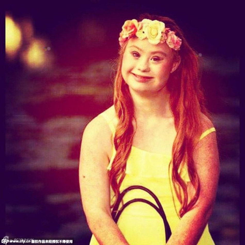 了世界上五位较为"另类"的模特儿,她们有的有白斑症,有的有唐氏综合症