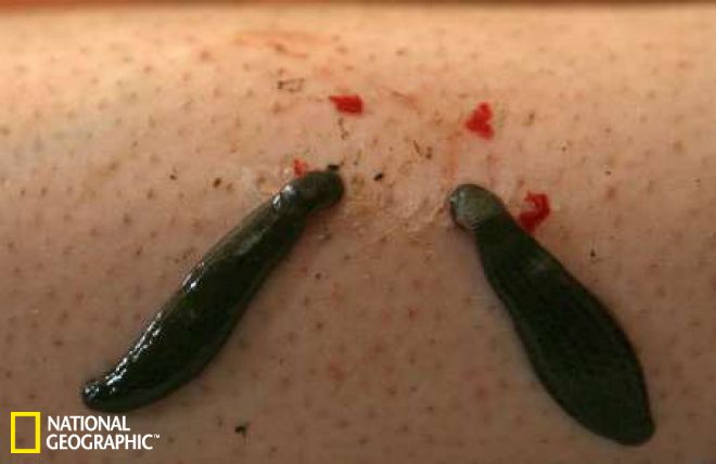 蚂蝗吸血身体图片