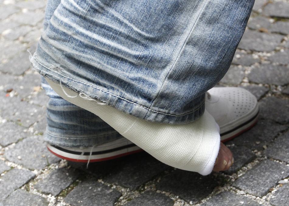 受伤的脚缠着绷带