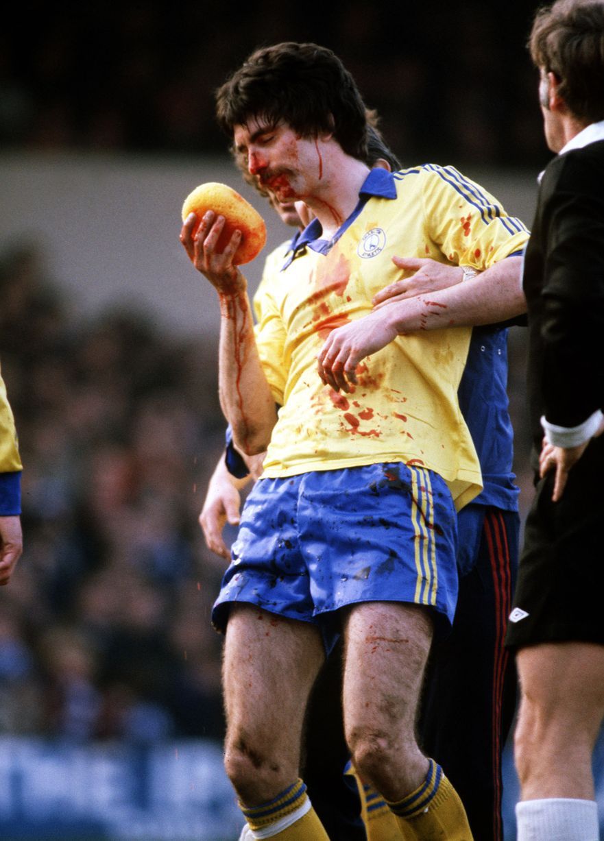 足球场血腥镜头集合_高清图集_新浪网