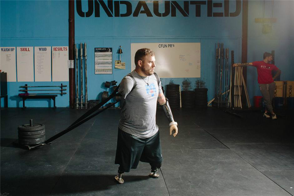 伤残美军士兵丧失四肢 刻苦锻炼成跑步运动员