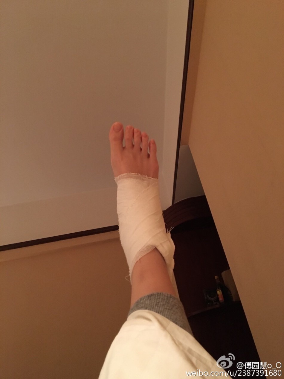 6 / 8 傅园慧昨晚在微博晒出面膜照,虽然脚踝淤青,洪荒少女依旧元气