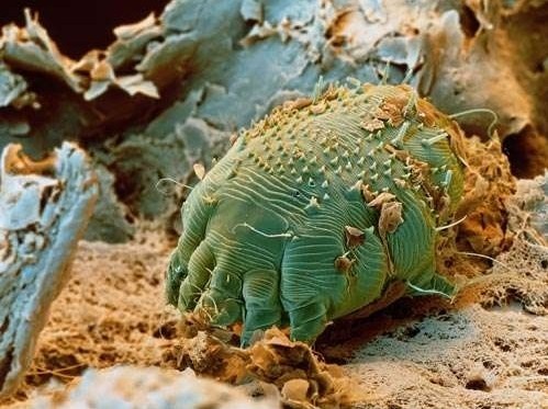 人体十大寄生虫的真面目_高清图集_新浪网