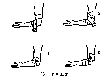 不同部位的绷带包扎步骤