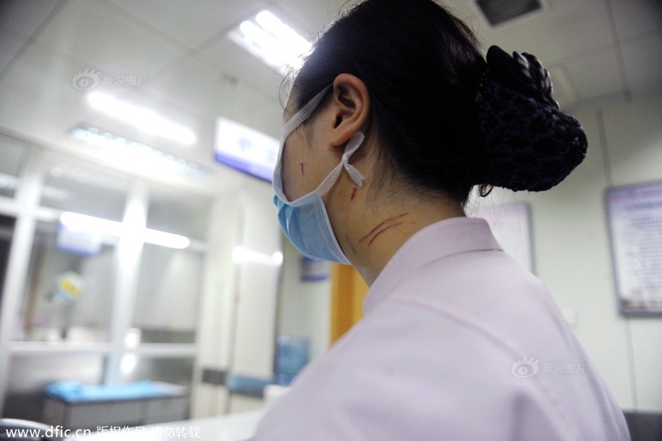 护士遭患儿家长打 因输液未"一针见血"