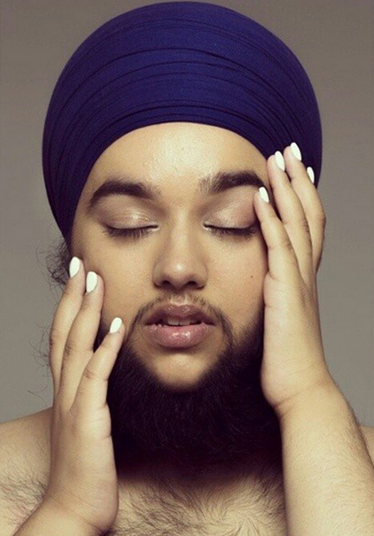 英国女子得怪病满脸胡须