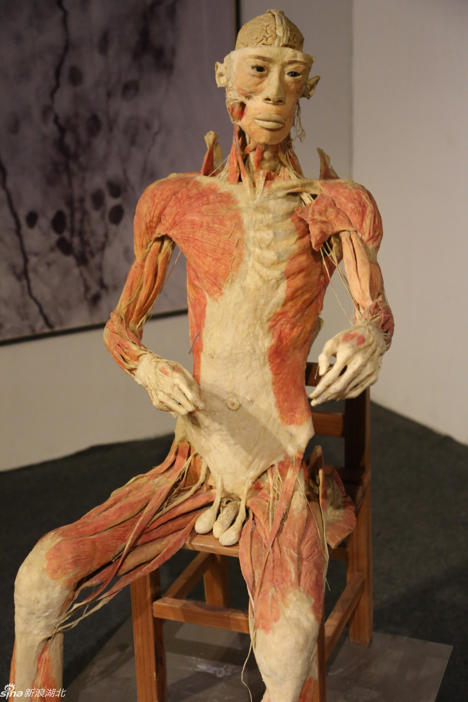 数百件人体标本空降江城 标本均采用真实人体