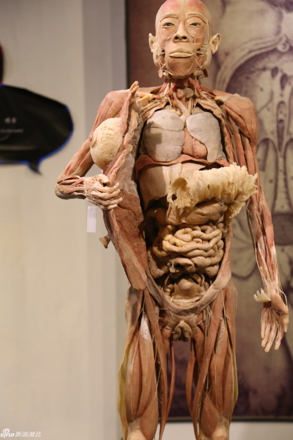数百件人体标本空降江城 标本均采用真实人体