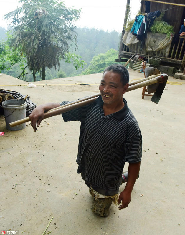 恩施六旬老人轮胎当脚照常干活 每晚用开水烫腿