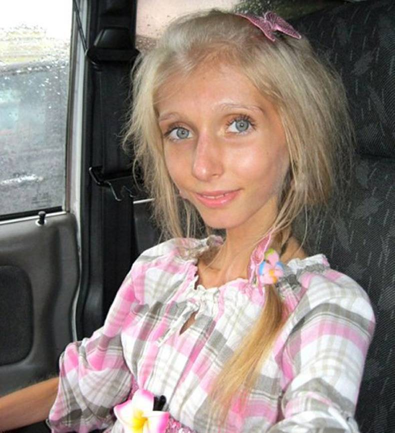 最瘦的美女8月17日锥子脸成中国形象3