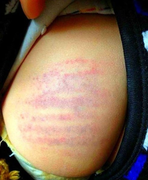 四岁幼儿没带作业本遭老师轮流鞭打