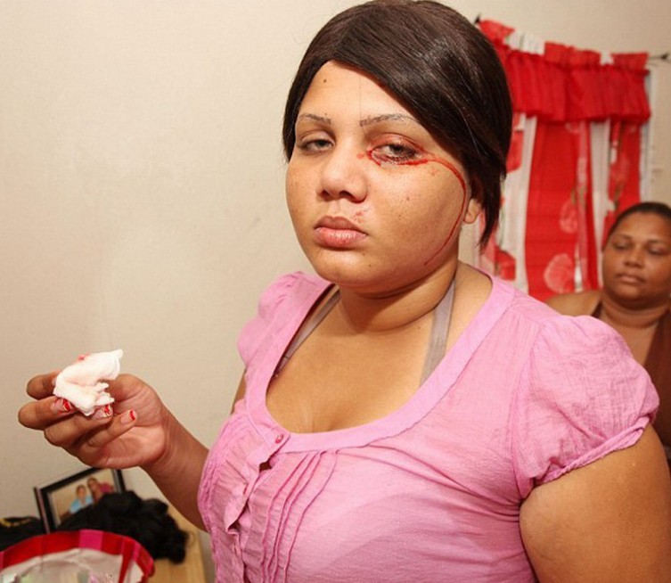 女孩德尔菲娜·塞德尼奥(delfina cedeno),4年前患上一种怪病——血汗