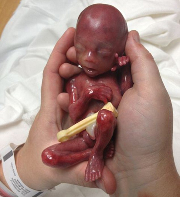 母亲记录早产儿短暂生命令人感动