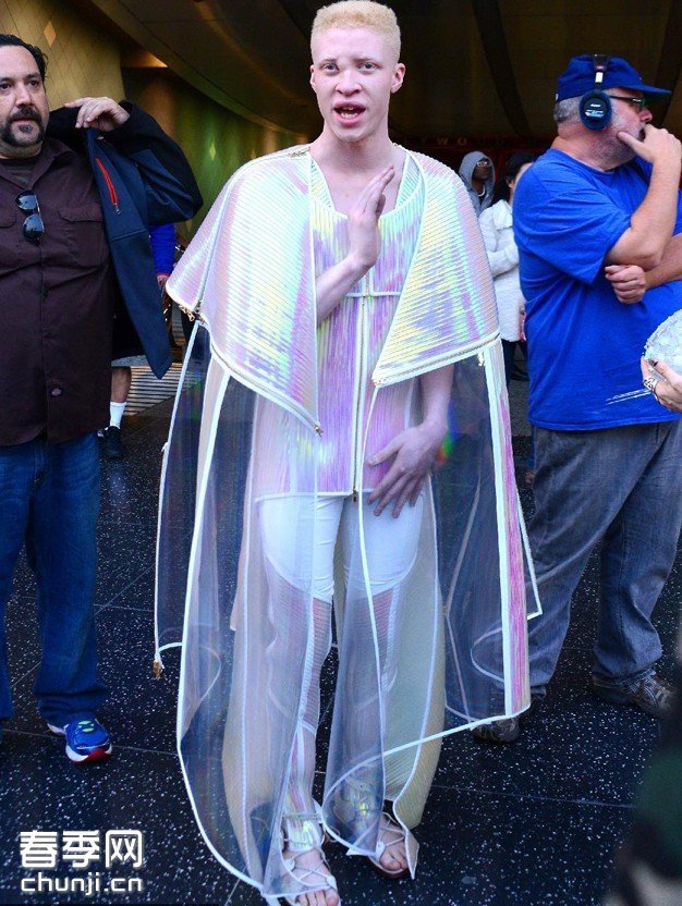 "白化病"男模shaun ross