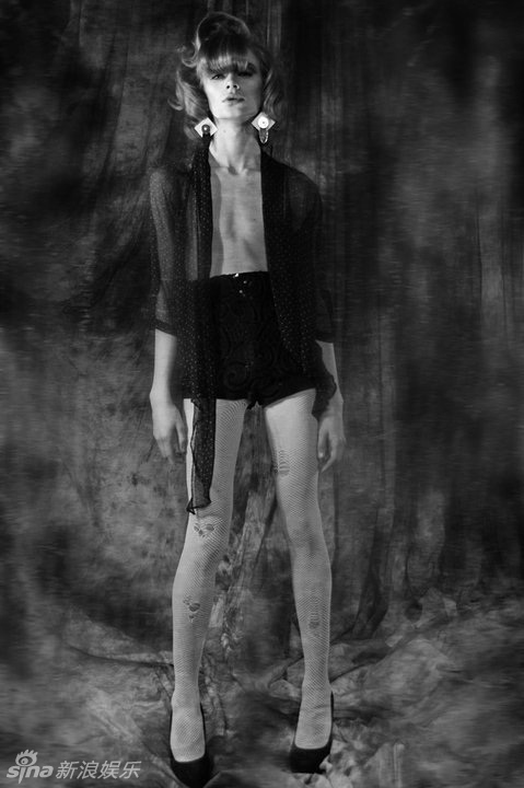 "白化病"男模shaun ross