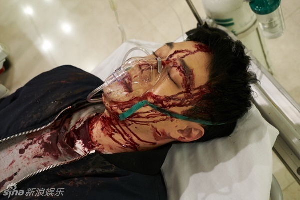 组图:《venus》苏志燮满脸血进急救室