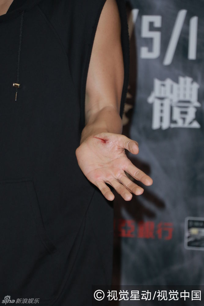 组图:林峰开唱手部受伤 淌了一手血被当成特效_高清图集_新浪网