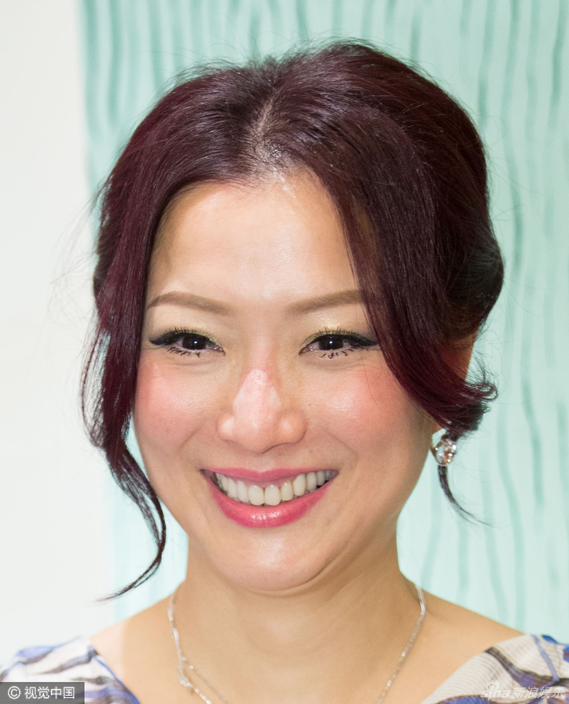 郑秀文面容大变样 鼻子带疤