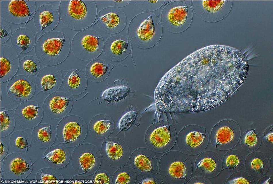 微观世界显微摄影佳作:蚂蚁搬运幼虫