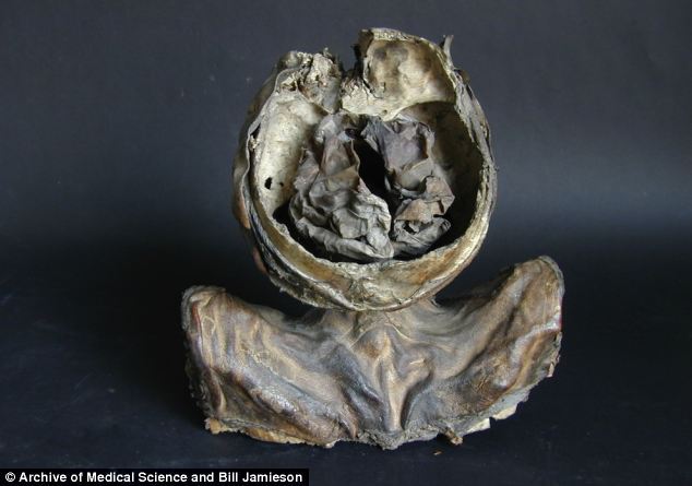 欧洲发现千年前干尸头颅:大脑切除或为标本