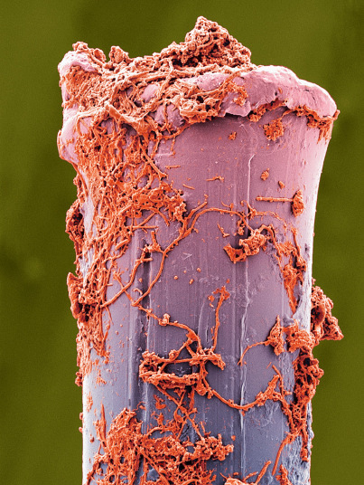 牙菌斑图片显微图片