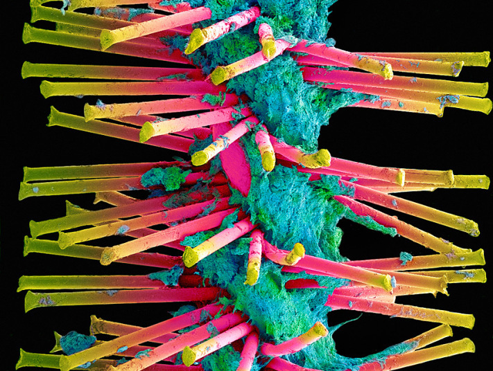 牙菌"斑斓":显微镜下的口腔生态