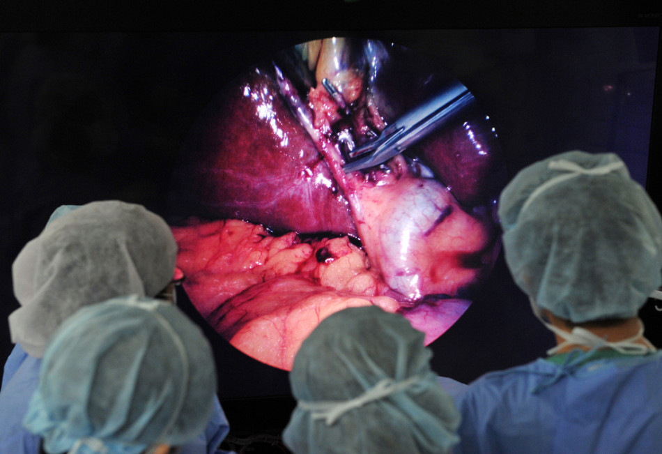 世界首例8k超高清内窥镜手术在日进行