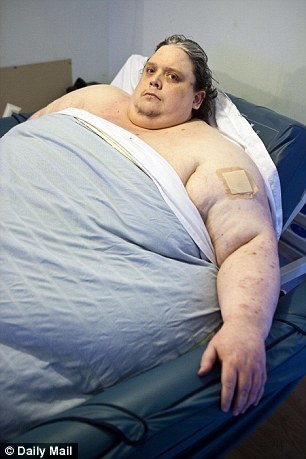 444公斤全球最胖男人死于肺炎:享年44岁