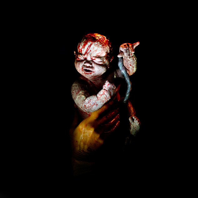 婴儿剖腹产出生瞬间 (/7)