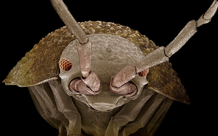 电子显微镜下的微小生命