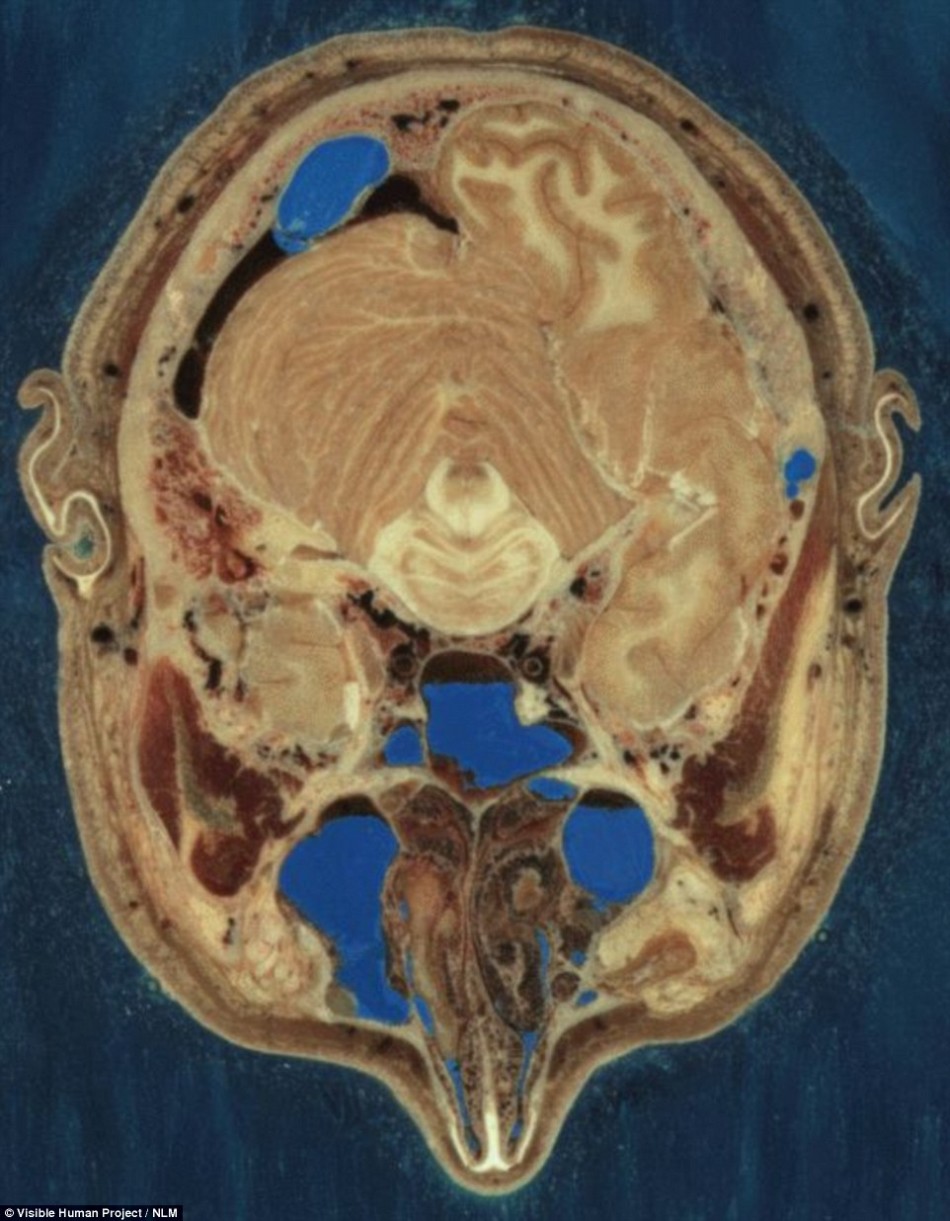 世界最详细人体图像:5000个切面扫描成像