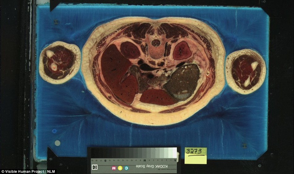 人体组织器官碎片图片