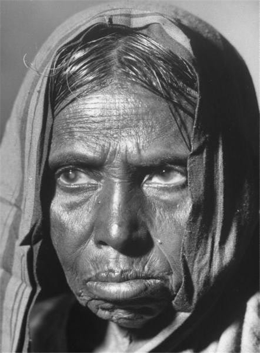 印度触目惊心的大饥荒 (/37)