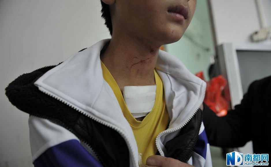 少年遭割颈险逃脱将罪犯反锁