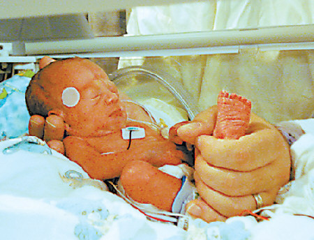 31周生下来的胎儿图图片
