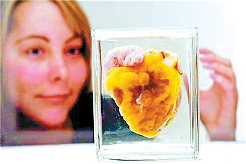 大活人看到了自己的心脏