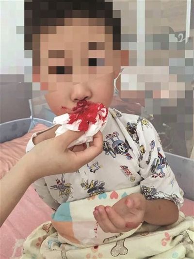 学生流鼻血家长质疑新修跑道