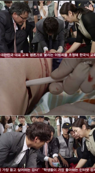 《Good Doctor》中做手术十分血腥