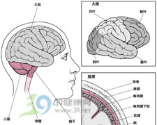 蛛网膜下腔出血位置示意图