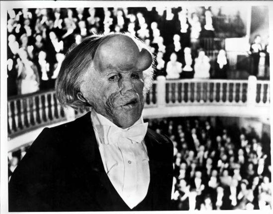 1980年约翰-赫特在电影中的象人扮相