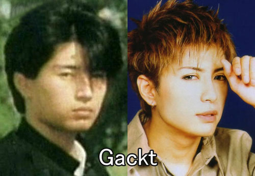 日本男星们的整容比拼--gackt