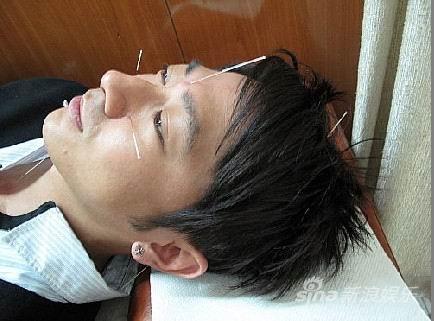 孙耀威忍痛接受针灸治疗 明年初回内地拍戏(图)