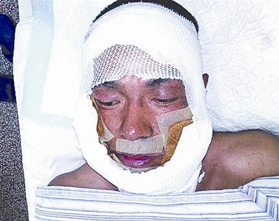 《高粱红了》王挺被爆炸烧伤