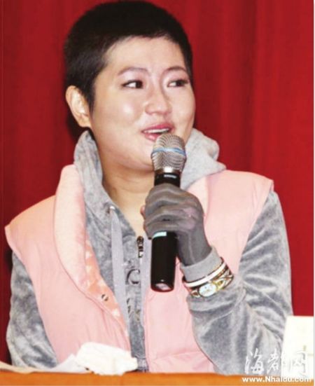 Selina被烧伤后首次面对媒体