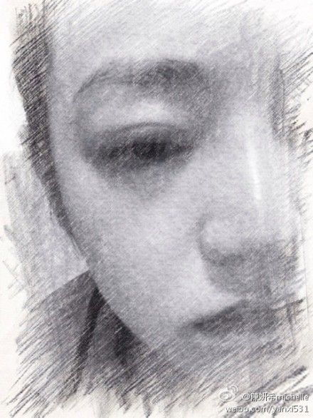 上个月陈妍希眼睛发炎，双眼皮肿得像核桃