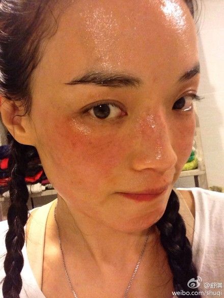 舒淇晒出过敏素颜照