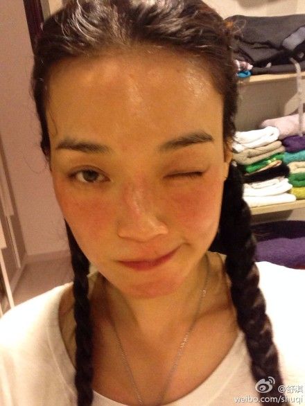 舒淇脸部过敏严重