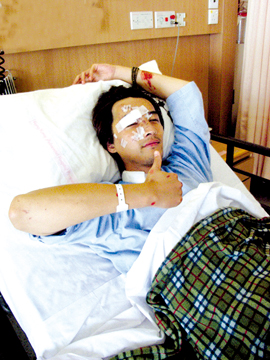 胡歌车祸"毁容"照首度曝光 面缝100多针(附图)