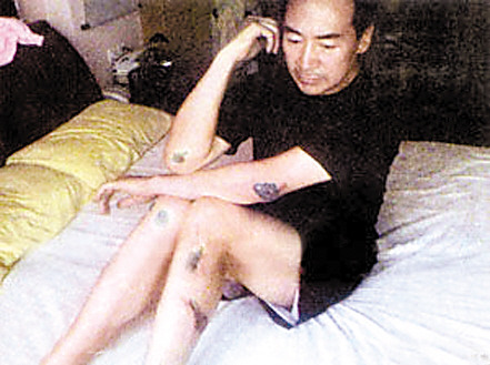 寇振海展示伤情