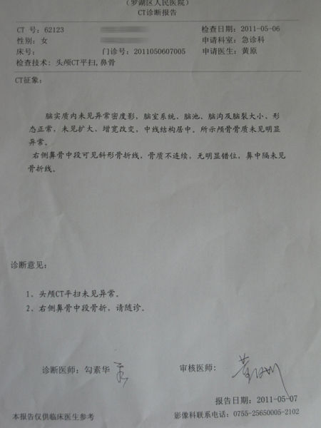 鼻骨骨折ct报告 头颅ct平扫